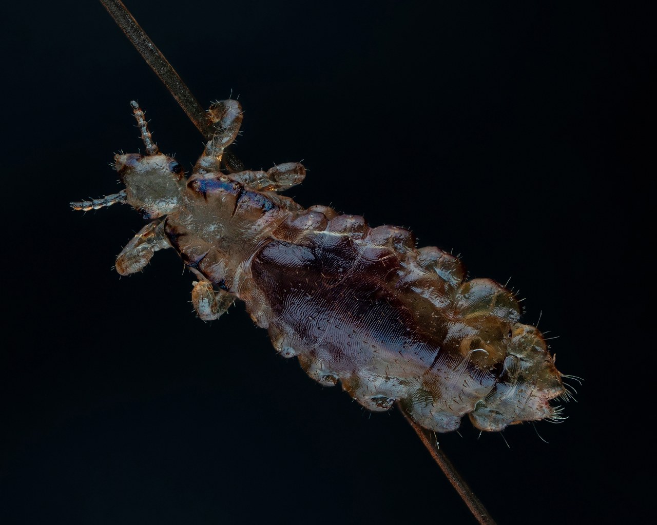 머릿니 죽이는 꿈 4